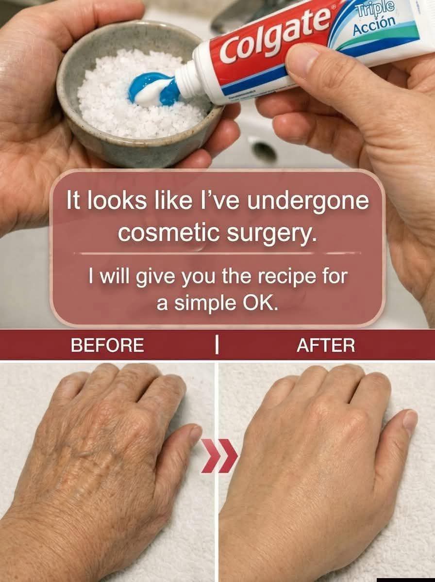 A Simple Homemade Routine to Improve the Appearance of Wrinkles And Age Spots on Hands